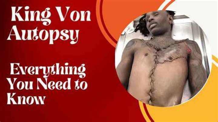 A Comprehensive Guide To Kong Von Autopsy: Uncovering The Chilling Details