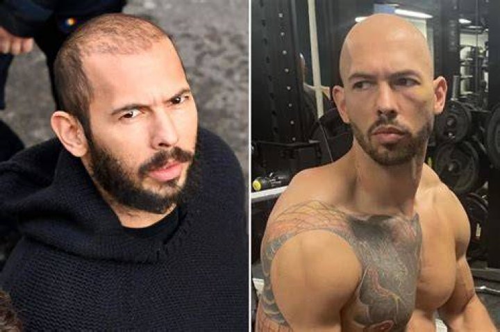 Andrew Tate mocked for boasting about his ‘full head of hair’ as he’s